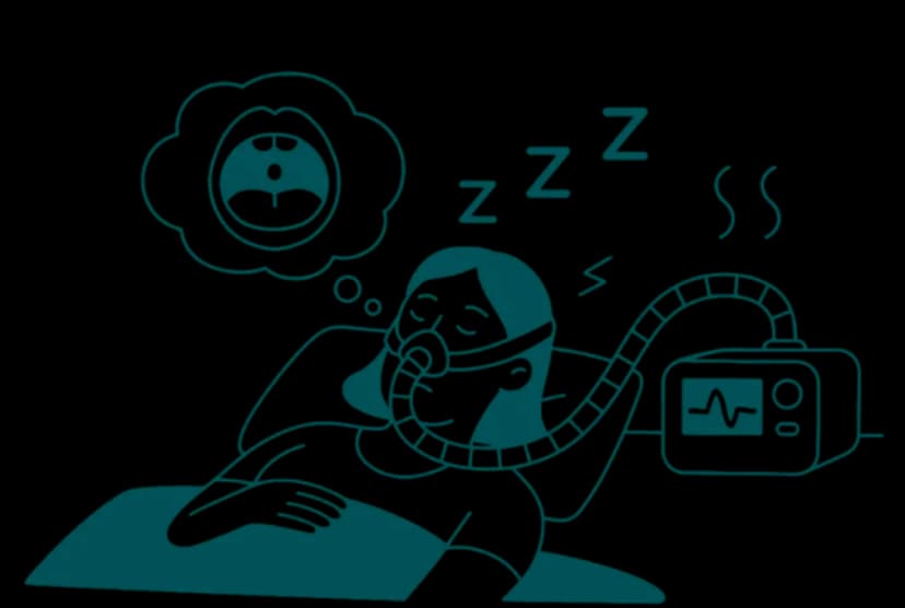 Sleep Apnea